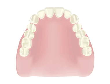 保険義歯の入れ歯イメージ